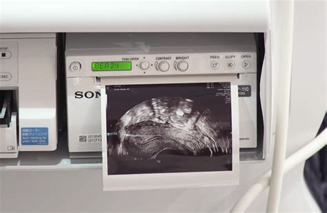 Where to Print Ultrasound Pictures: A Diverse Range of Options to Consider